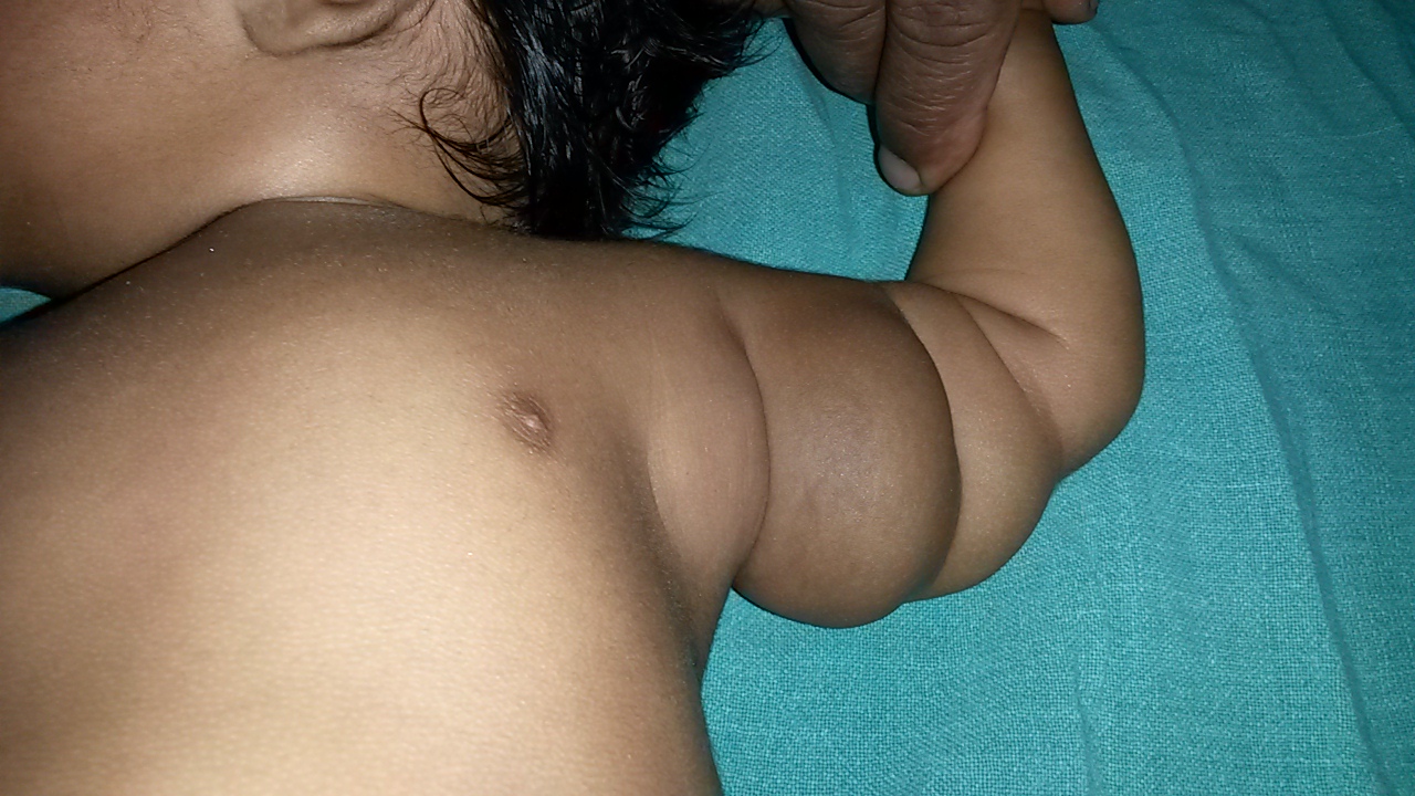 Pediatric General Surgery Image 3